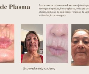 WhatsApp-Image-2024-07-08-at-10.54.47-1